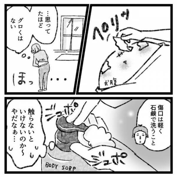 「ぶりゅっ」→ギャーッ！おなかの傷口から出てきたものとは！？＜おなかの爆弾とりました＞