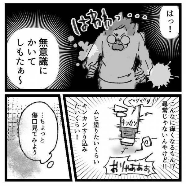 「ぶりゅっ」→ギャーッ！おなかの傷口から出てきたものとは！？＜おなかの爆弾とりました＞