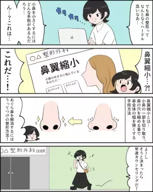 「小さくしたい！」小鼻が広がるあぐら鼻。コンプレックス解決法は？ ＜鼻翼縮小レポ＞