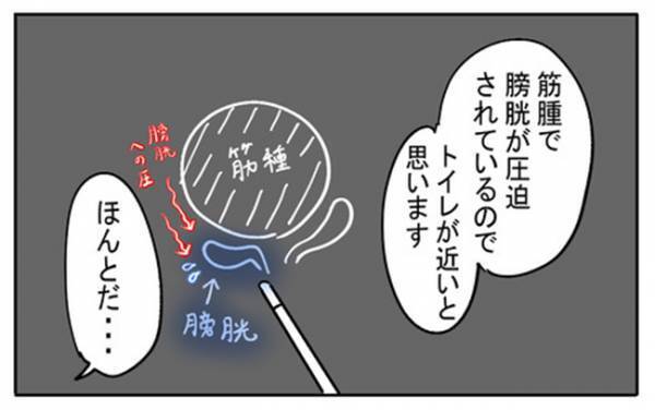 「トイレが近くないですか？」→理由を知って納得！医師の質問の意図とは？＜不妊の原因は？＞