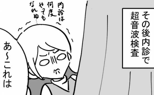 「あ〜これは…」経腟エコーで子宮の状態を診てもらうと…医師の見解は！？＜不妊の原因は？＞