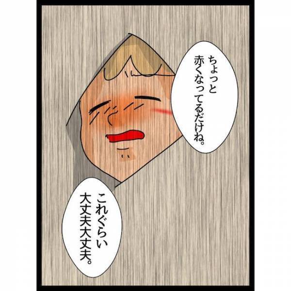 「…え？」子どもの顔見せに義母宅へ。子どもが怪我をすると驚愕の発言を＜義母の猫が招いたトラブル＞