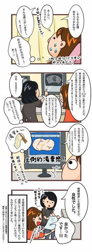 「摘出したのはこちらです」…ギョッ！画面に映し出されていた物に＜卵巣嚢腫手術＞