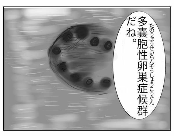 「私…赤ちゃんできないの？」婦人科を受診するとまさかの…！＜PCOSの私が自然妊娠するまで ＞