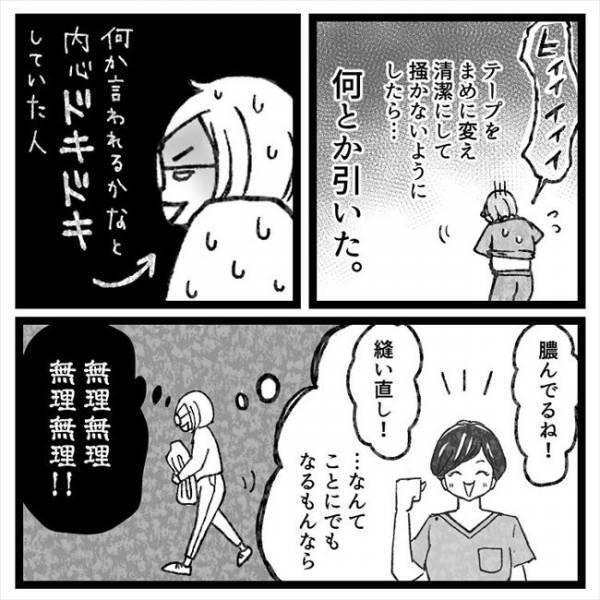 「…あれっ？」まじまじとへそを見つめられ…医師からまさかのひと言！＜おなかの爆弾とりました＞