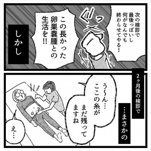 「…あれっ？」まじまじとへそを見つめられ…医師からまさかのひと言！＜おなかの爆弾とりました＞