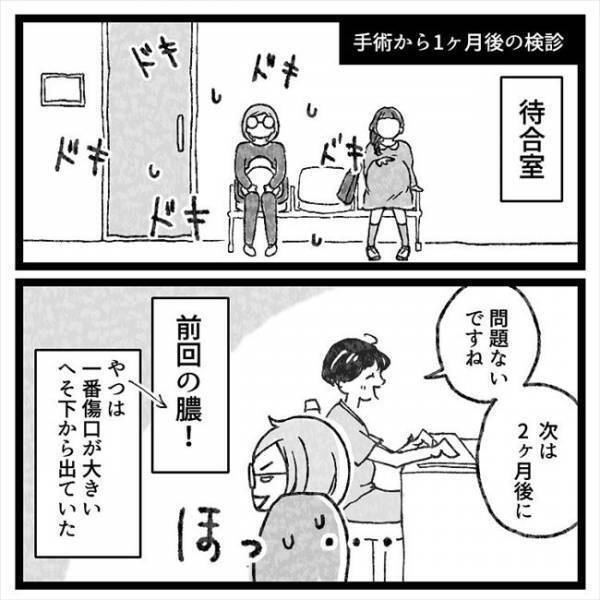 「…あれっ？」まじまじとへそを見つめられ…医師からまさかのひと言！＜おなかの爆弾とりました＞