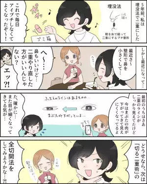 「二重やり直したら？」埋没法から5年。まぶたの状態に異変が？！＜二重切開レポ＞