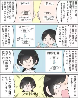 「寄り目になるかも」平行二重は無理！？そのワケは？＜二重切開レポ＞