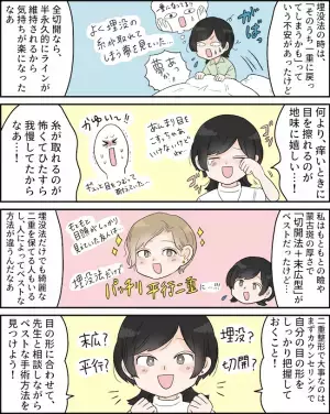 「半永久だから安心」埋没法時代に恐れていたあの悩みから解放！＜二重切開レポ＞