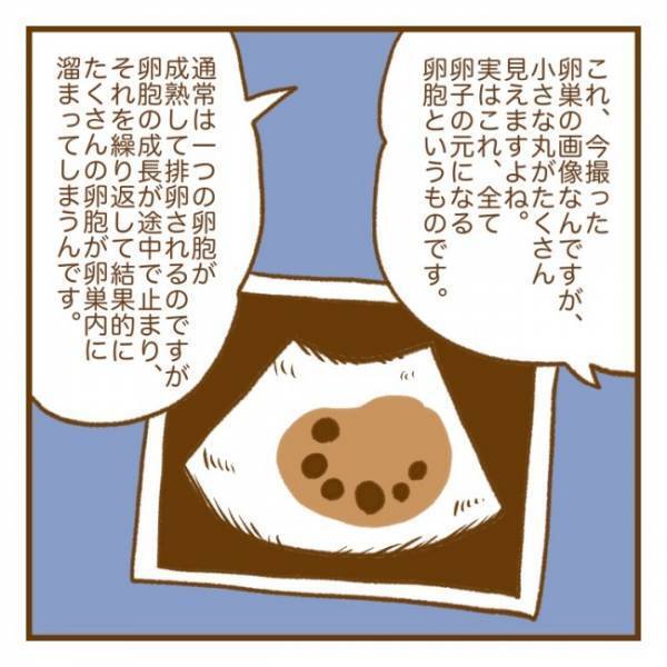 「これはおそらく…」初めて聞く病名に思わず動揺。医師が告げた診断名とは？＜PCOSの妊活記録＞