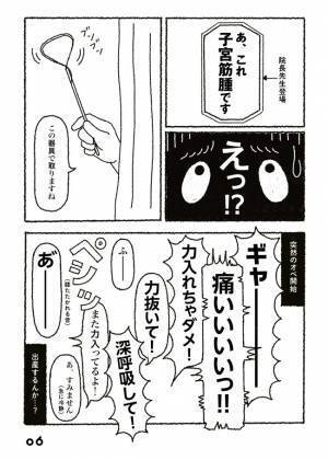 「いったい…何！？」股の間に何かある。婦人科へ駆け込むと？＜子宮筋腫メモリーズ＞