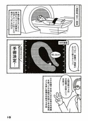 「手術ですか？」MRI検査の結果、見つかったものは…＜子宮筋腫メモリーズ ＞