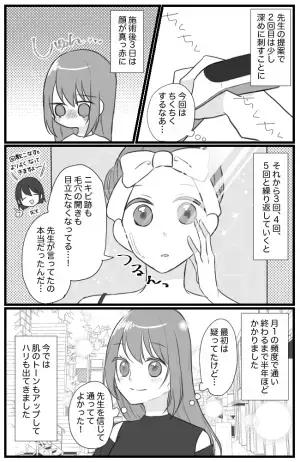 なんとかしたい！毛穴の開き＆ニキビ跡⇒ある方法を試した結果…？！【ダーマペン体験マンガ】