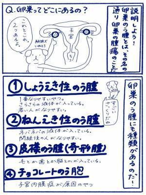 「爆発するかもね」ばくはつ！？婦人科で医師の口から飛び出したことは＜卵巣嚢腫手術レポ＞