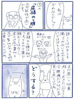「爆発するかもね」ばくはつ！？婦人科で医師の口から飛び出したことは＜卵巣嚢腫手術レポ＞