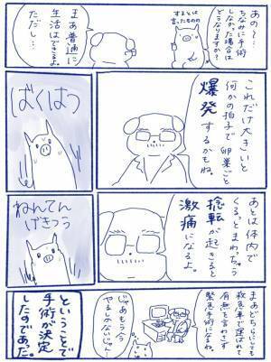 「爆発するかもね」ばくはつ！？婦人科で医師の口から飛び出したことは＜卵巣嚢腫手術レポ＞