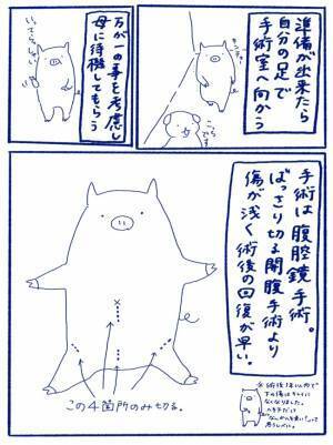 「いくね。3、2、1…」→あ…一瞬で目の前が真っ暗になり、ついにそのときが＜卵巣嚢腫手術レポ＞