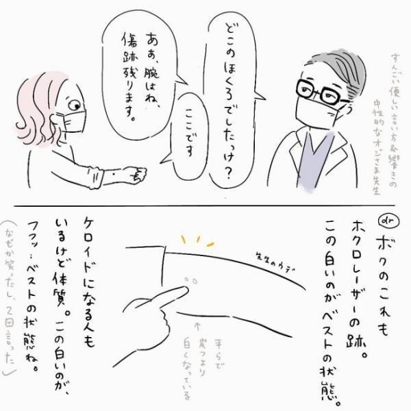 「傷跡が残ります」医師に「腕のあるもの」を見せた結果、告げられたのは！？＜ほくろ除去レポ＞