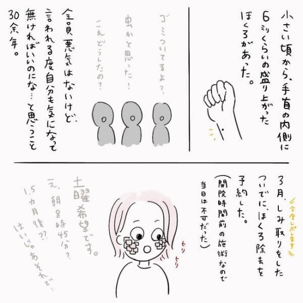 「傷跡が残ります」医師に「腕のあるもの」を見せた結果、告げられたのは！？＜ほくろ除去レポ＞