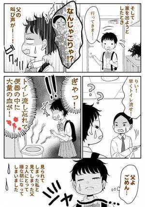 「なんじゃこりゃ！？」私のあとにトイレに入った父が大絶叫！便器を見てみると！？