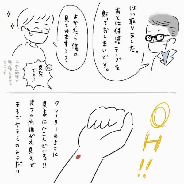 「えええ！？」ほくろを取ってお会計で告げられた金額→予想と違って？＜ほくろ除去レポ＞