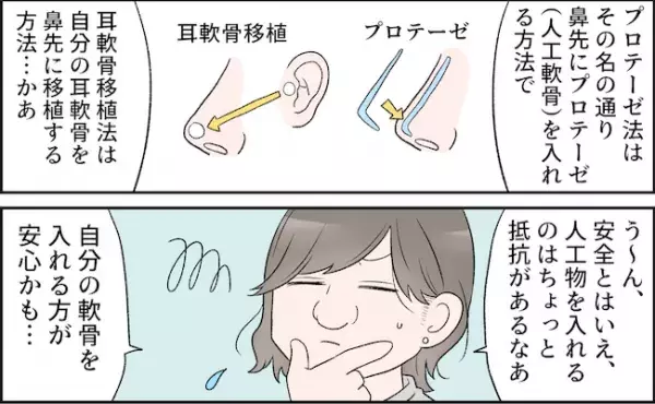 「耳軟骨を鼻先に」ニンニク鼻をすっきり鼻にする方法は？！＜耳介軟骨移植レポ ＞