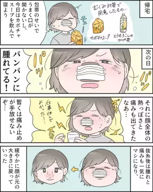 「顔がパンパン」ダウンタイムを乗り越え半年後⇒ニンニク鼻はどうなった？＜耳介軟骨移植レポ ＞