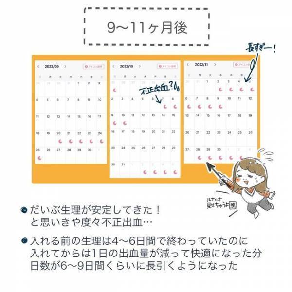 「正直どうなの？」ミレーナを入れて1年以上→体の状態は…？！＜ミレーナと1年4カ月＞