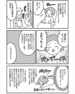 「怖いよぉ」麻酔を使わないで体の一部を切る？！その痛みは…！＜HPVかも？＞