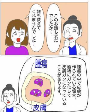 「えっ…がん化！？」そんな可能性もあるなんて。医師の言葉に思わず＜半分になった卵巣＞