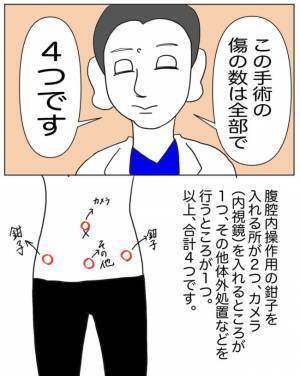 「手術の話をします」緊張の瞬間。思わず困惑してしまったこととは？＜半分になった卵巣＞
