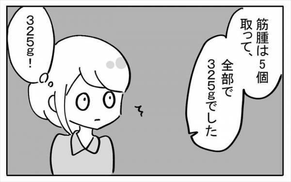 「そんなにあったの！？」子宮から取り出した腫瘍の重さはなんと＜不妊の原因は？＞