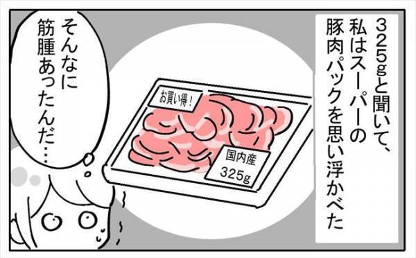 「そんなにあったの！？」子宮から取り出した腫瘍の重さはなんと＜不妊の原因は？＞
