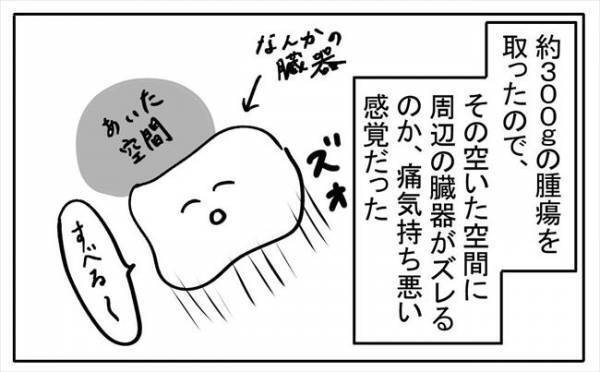 「ゴポゴポッ」内臓が大移動！？おなかから出る不気味な音の正体は＜不妊の原因は？＞