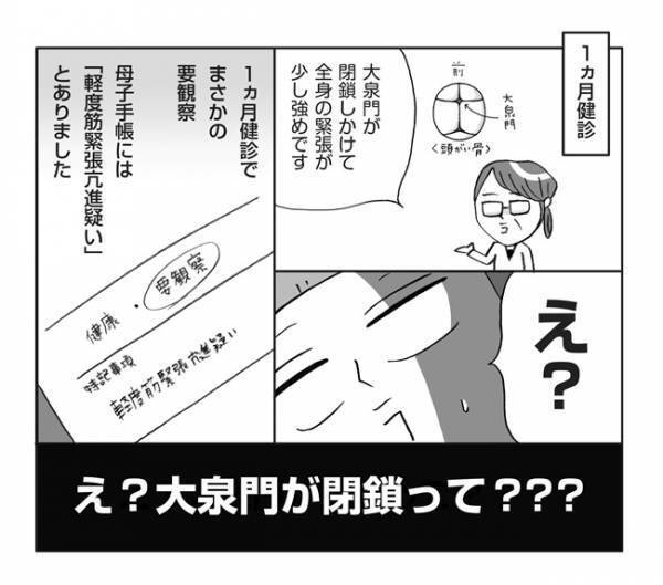 「え！頭の大泉門が閉鎖って…？」赤ちゃんが軽度筋緊張亢進疑いと診断されて【体験談マンガ】