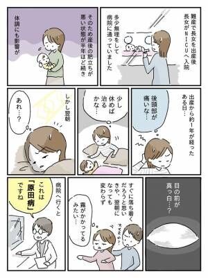 原田病の体験談