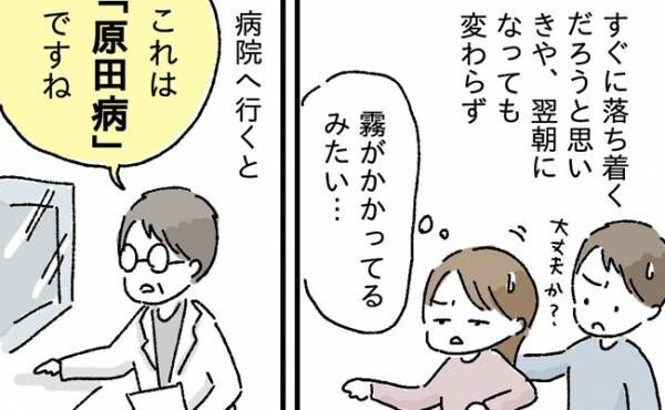 「突然、目が見えない状態に」出産から1年後、原田病を発症。子どもの顔もよく見えず困惑