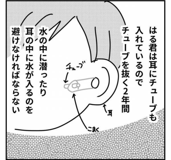 息子の耳にチューブを挿入。ひとりだけ保育園のプールに入れないときは＜子どもの手術入院＞