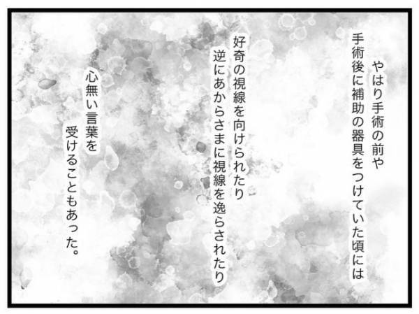 「妊娠中に抱えていた不安は…」両側性唇顎裂の娘を出産。母が娘に伝えたい言葉とは