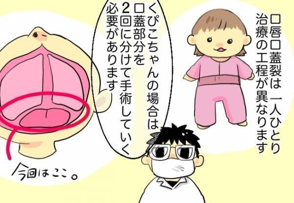 衝撃！え…2回も手術するの！？【口唇口蓋裂ちゃん、育ててます】