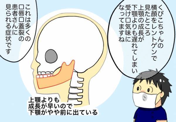 「えっ、骨を動かすって…！？」歯科治療の先生から言われた説明に仰天！