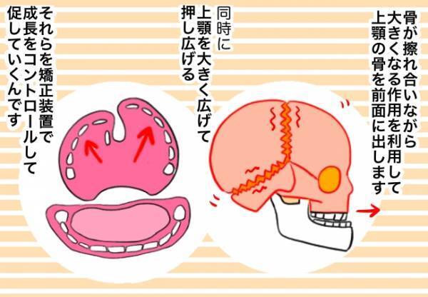 「えっ、骨を動かすって…！？」歯科治療の先生から言われた説明に仰天！