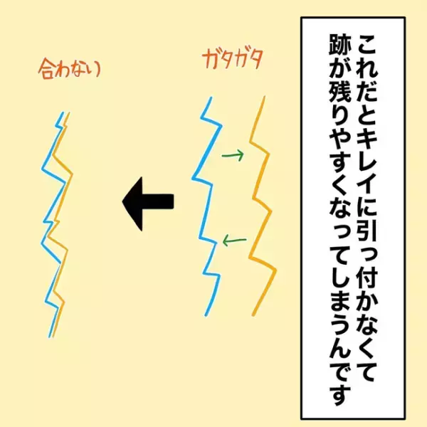 「まさかそんなっ！？」医師の言葉に落胆する。そんな状況に息子は？＜1歳児がソファから落ちた＞