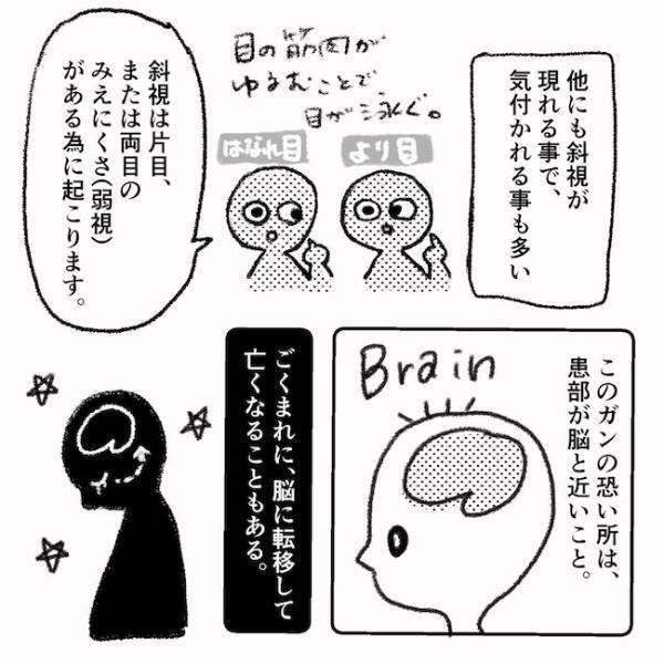 「ギャァァ！」家族ドン引き！赤ちゃんの目の検査方法とは…＜息子の目に障がい＞