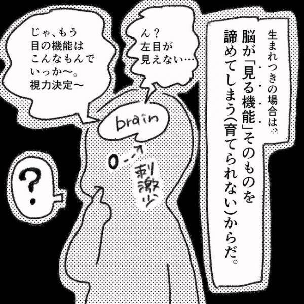 「ギャァァ！」家族ドン引き！赤ちゃんの目の検査方法とは…＜息子の目に障がい＞
