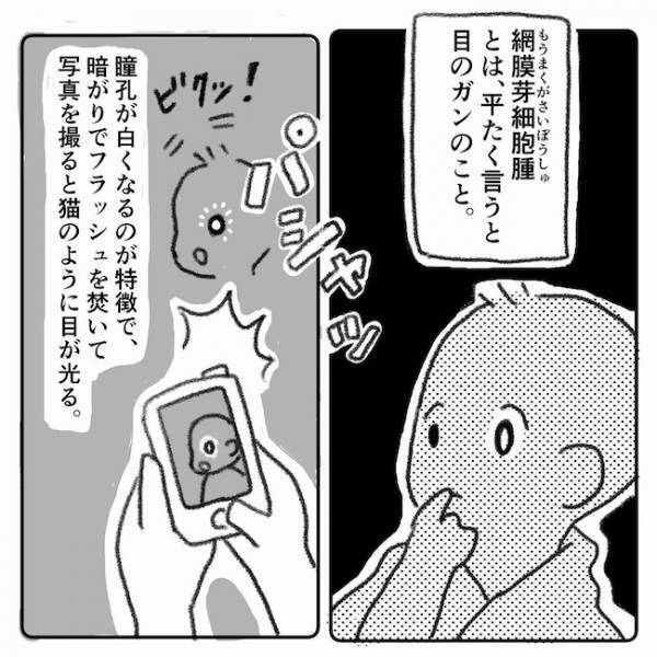 「ギャァァ！」家族ドン引き！赤ちゃんの目の検査方法とは…＜息子の目に障がい＞