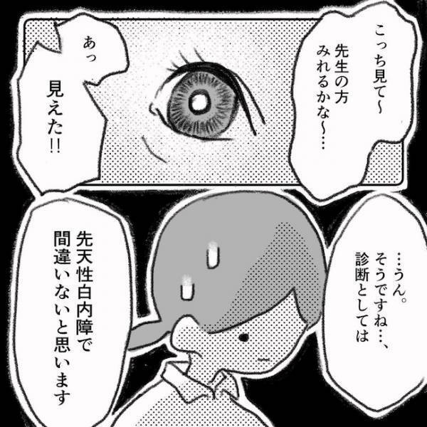 「どんな息子も受け入れる」覚悟を決めたママ。結果を聞いたパパの反応は…＜息子の目に障がい＞