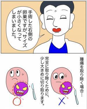 「卵巣が半分になりました」医師の言葉にショックもあり安堵な気持ちもあり＜半分になった卵巣＞