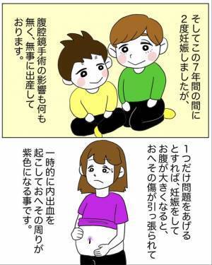 「卵巣が半分になりました」医師の言葉にショックもあり安堵な気持ちもあり＜半分になった卵巣＞